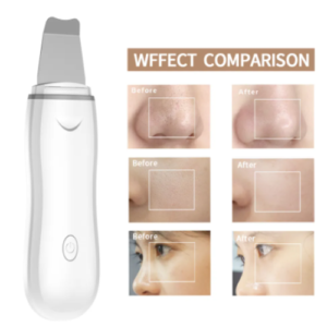 Wholesale Professional Skin Care Facial Exfoliating Device Ultrasonic Skin Scrubber Deep Face Cleaning Face Skin Scrubber